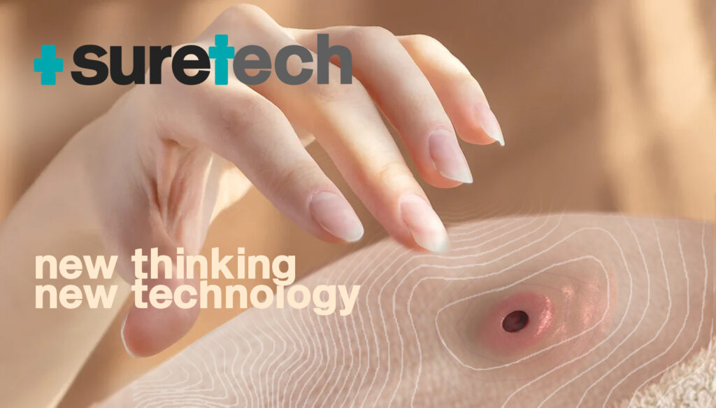 ANSAgrip Suretech Stoma component manufacture UK 002